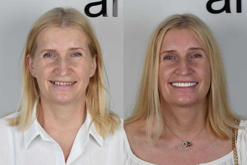 before after dental image